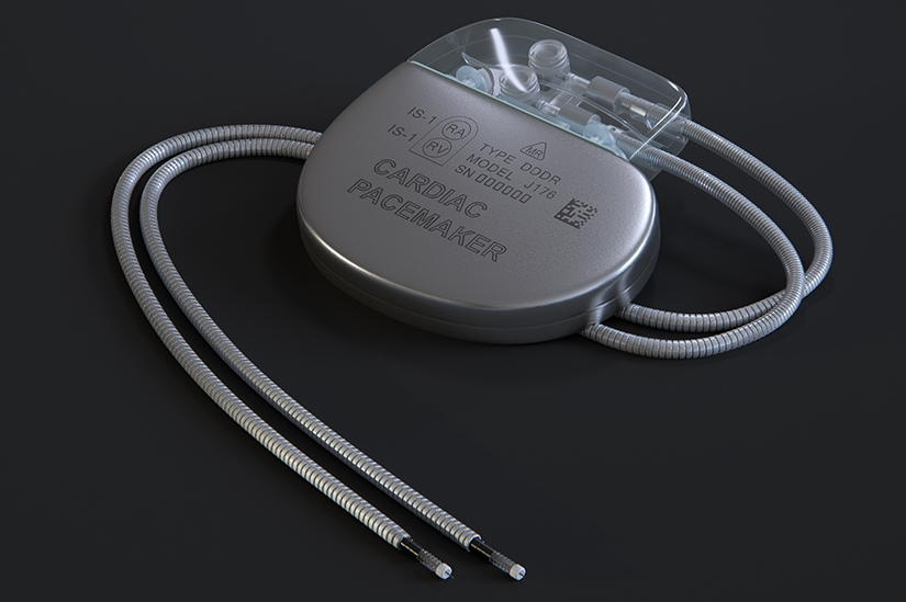 CardiacPICUスタンダード　裁断済み Implantare stimulator cardiac permanent | Reginamaria.ro